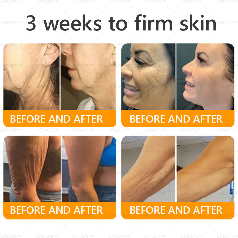 Made and Shipped from the UK ✅ 𝐀𝐖𝐙𝐋𝐎𝐕𝐄® Bee venom Comprehensive Cream 🔥 LAST DAY 80% OFF 🐝