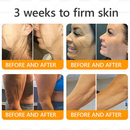 Made and Shipped from the UK ✅ 𝐀𝐖𝐙𝐋𝐎𝐕𝐄® Bee venom Comprehensive Cream 🔥 LAST DAY 80% OFF 🐝