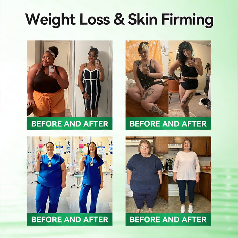 𝑶𝒇𝒇𝒊𝒄𝒊𝒂𝒍 𝑺𝒕𝒐𝒓𝒆 | 👩‍⚕️ H𝐞a𝐥r𝐢z𝐞® 1𝟐-𝐈N-1 M𝐨r𝐢n𝐠a * B𝐞r𝐛e𝐫i𝐧e * N𝐀D+ 𝐀d𝐯a𝐧c𝐞d N𝐚n𝐨 𝐌i𝐜r𝐨n𝐞e𝐝l𝐞 𝐏a𝐭c𝐡 (𝐎𝐧𝐜𝐞 𝐃𝐚𝐢𝐥𝐲, 𝐯𝐢𝐬𝐢𝐛𝐥𝐞 𝐜𝐡𝐚𝐧𝐠𝐞𝐬 𝐢𝐧 𝟕 𝐝𝐚𝐲𝐬）💫 F𝐨r 𝐎𝐛𝐞𝐬𝐢𝐭𝐲, 𝐋o𝐨s𝐞 𝐒k𝐢n, 𝐃𝐢𝐚𝐛𝐞𝐭𝐞𝐬, 𝐒𝐥𝐞𝐞𝐩 𝐀𝐩𝐧𝐞𝐚, 𝐀𝐧𝐝 𝐉𝐨𝐢𝐧𝐭 𝐈𝐬𝐬𝐮𝐞𝐬 , 𝐉𝐨𝐢𝐧𝐭 𝐈𝐬𝐬𝐮𝐞𝐬 𝐀𝐧𝐝 m𝐨r𝐞💫