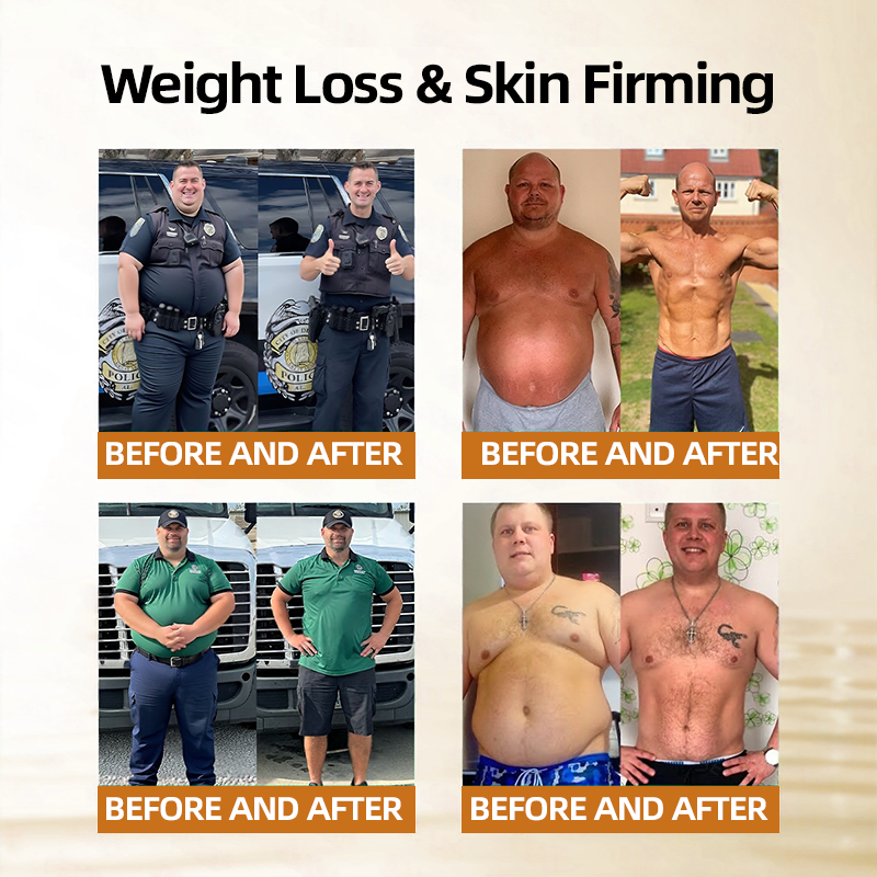 𝑶𝒇𝒇𝒊𝒄𝒊𝒂𝒍 𝑺𝒕𝒐𝒓𝒆☀️👉| 𝐇𝐞𝐚𝐥𝐫𝐢𝐳𝐞®👩‍⚕️𝐌𝐨𝐫𝐢𝐧𝐠𝐚 𝐁𝐞𝐫𝐛𝐞𝐫𝐢𝐧𝐞 𝟏𝟎-𝐢𝐧-𝟏 𝐌𝐢𝐜𝐫𝐨𝐠𝐫𝐚𝐧𝐮𝐥𝐞 𝐁𝐨𝐝𝐲-𝐒𝐡𝐚𝐩𝐢𝐧𝐠 𝐅𝐚𝐭-𝐁𝐮𝐫𝐧𝐢𝐧𝐠 𝐏𝐚𝐭𝐜𝐡(𝐎𝐧𝐜𝐞 𝐃𝐚𝐢𝐥𝐲, 𝐯𝐢𝐬𝐢𝐛𝐥𝐞 𝐜𝐡𝐚𝐧𝐠𝐞𝐬 𝐢𝐧 𝟕 𝐝𝐚𝐲𝐬）𝟓𝐗 𝐒𝐰𝐞𝐚𝐭 𝐏𝐫𝐨𝐝𝐮𝐜𝐭𝐢𝐨𝐧. 𝐅𝐨𝐫 𝐎𝐛𝐞𝐬𝐢𝐭𝐲, 𝐋𝐨𝐨𝐬𝐞 𝐒𝐤𝐢𝐧, 𝐃𝐢𝐚𝐛𝐞𝐭𝐞𝐬, 𝐒𝐥𝐞𝐞𝐩 𝐀𝐩𝐧𝐞𝐚, 𝐀𝐧𝐝 𝐉𝐨𝐢𝐧𝐭 𝐈𝐬𝐬𝐮𝐞𝐬