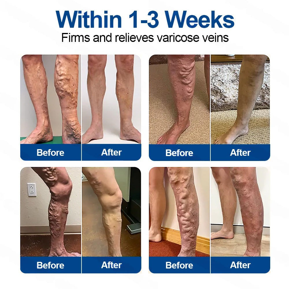 𝗛𝗲𝗮𝗹𝗿𝗶𝘇𝗲® 𝗩𝗲𝗶𝗻𝗧𝗮𝗿𝗴𝗲𝘁 𝗠𝗶𝗰𝗿𝗼𝗻𝗲𝗲𝗱𝗹𝗲 𝗣𝗮𝘁𝗰𝗵🌾🥬𝗜𝗻𝘀𝘁𝗮𝗻𝘁 𝗥𝗲𝗹𝗶𝗲𝗳, 𝗟𝗼𝗻𝗴-𝗧𝗲𝗿𝗺 𝗥𝗲𝘀𝘂𝗹𝘁𝘀✅uk