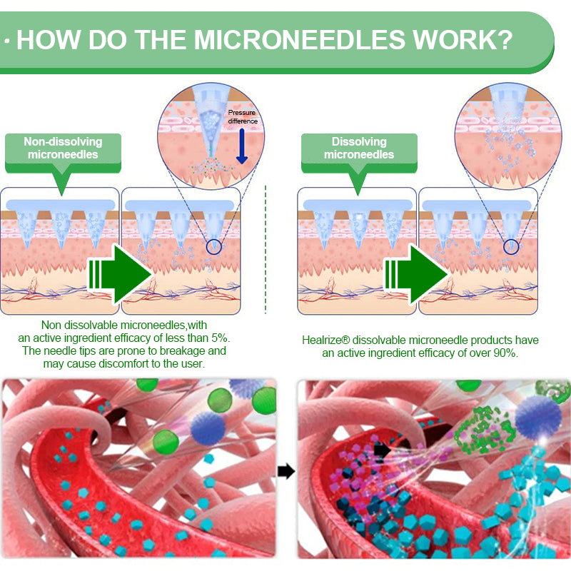 𝑶𝒇𝒇𝒊𝒄𝒊𝒂𝒍 𝑺𝒕𝒐𝒓𝒆| 👩‍⚕️𝐇e𝐚l𝐫i𝐳e®𝟏2-i𝐧-𝟏 M𝐨r𝐢n𝐠a * B𝐞r𝐛e𝐫i𝐧e * N𝐀D+ 𝐀d𝐯a𝐧c𝐞d N𝐚n𝐨 𝐌i𝐜r𝐨n𝐞e𝐝l𝐞 𝐏a𝐭c𝐡 (𝐎𝐧𝐜𝐞 𝐃𝐚𝐢𝐥𝐲, 𝐯𝐢𝐬𝐢𝐛𝐥𝐞 𝐜𝐡𝐚𝐧𝐠𝐞𝐬 𝐢𝐧 𝟕 𝐝𝐚𝐲𝐬）🏵️F𝐨r 𝐎𝐛𝐞𝐬𝐢𝐭𝐲, 𝐋o𝐨s𝐞 𝐒k𝐢n, 𝐃𝐢𝐚𝐛𝐞𝐭𝐞𝐬, 𝐒𝐥𝐞𝐞𝐩 𝐀𝐩𝐧𝐞𝐚, 𝐀𝐧𝐝 𝐉𝐨𝐢𝐧𝐭 𝐈𝐬𝐬𝐮𝐞𝐬🏵️