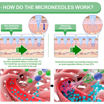 𝑶𝒇𝒇𝒊𝒄𝒊𝒂𝒍 𝑺𝒕𝒐𝒓𝒆| 👩‍⚕️𝐇e𝐚l𝐫i𝐳e®𝟏2-i𝐧-𝟏 M𝐨r𝐢n𝐠a * B𝐞r𝐛e𝐫i𝐧e * N𝐀D+ 𝐀d𝐯a𝐧c𝐞d N𝐚n𝐨 𝐌i𝐜r𝐨n𝐞e𝐝l𝐞 𝐏a𝐭c𝐡 (𝐎𝐧𝐜𝐞 𝐃𝐚𝐢𝐥𝐲, 𝐯𝐢𝐬𝐢𝐛𝐥𝐞 𝐜𝐡𝐚𝐧𝐠𝐞𝐬 𝐢𝐧 𝟕 𝐝𝐚𝐲𝐬）🏵️F𝐨r 𝐎𝐛𝐞𝐬𝐢𝐭𝐲, 𝐋o𝐨s𝐞 𝐒k𝐢n, 𝐃𝐢𝐚𝐛𝐞𝐭𝐞𝐬, 𝐒𝐥𝐞𝐞𝐩 𝐀𝐩𝐧𝐞𝐚, 𝐀𝐧𝐝 𝐉𝐨𝐢𝐧𝐭 𝐈𝐬𝐬𝐮𝐞𝐬🏵️