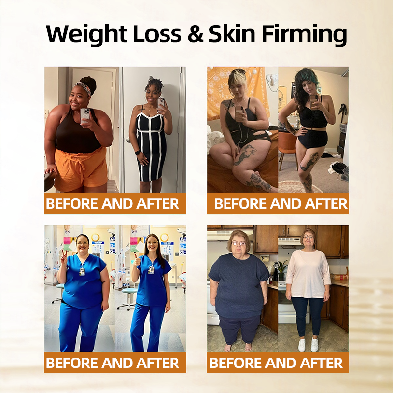 𝑶𝒇𝒇𝒊𝒄𝒊𝒂𝒍 𝑺𝒕𝒐𝒓𝒆☀️👉| 𝐇𝐞𝐚𝐥𝐫𝐢𝐳𝐞®👩‍⚕️𝐌𝐨𝐫𝐢𝐧𝐠𝐚 𝐁𝐞𝐫𝐛𝐞𝐫𝐢𝐧𝐞 𝟏𝟎-𝐢𝐧-𝟏 𝐌𝐢𝐜𝐫𝐨𝐠𝐫𝐚𝐧𝐮𝐥𝐞 𝐁𝐨𝐝𝐲-𝐒𝐡𝐚𝐩𝐢𝐧𝐠 𝐅𝐚𝐭-𝐁𝐮𝐫𝐧𝐢𝐧𝐠 𝐏𝐚𝐭𝐜𝐡(𝐎𝐧𝐜𝐞 𝐃𝐚𝐢𝐥𝐲, 𝐯𝐢𝐬𝐢𝐛𝐥𝐞 𝐜𝐡𝐚𝐧𝐠𝐞𝐬 𝐢𝐧 𝟕 𝐝𝐚𝐲𝐬）𝟓𝐗 𝐒𝐰𝐞𝐚𝐭 𝐏𝐫𝐨𝐝𝐮𝐜𝐭𝐢𝐨𝐧. 𝐅𝐨𝐫 𝐎𝐛𝐞𝐬𝐢𝐭𝐲, 𝐋𝐨𝐨𝐬𝐞 𝐒𝐤𝐢𝐧, 𝐃𝐢𝐚𝐛𝐞𝐭𝐞𝐬, 𝐒𝐥𝐞𝐞𝐩 𝐀𝐩𝐧𝐞𝐚, 𝐀𝐧𝐝 𝐉𝐨𝐢𝐧𝐭 𝐈𝐬𝐬𝐮𝐞𝐬