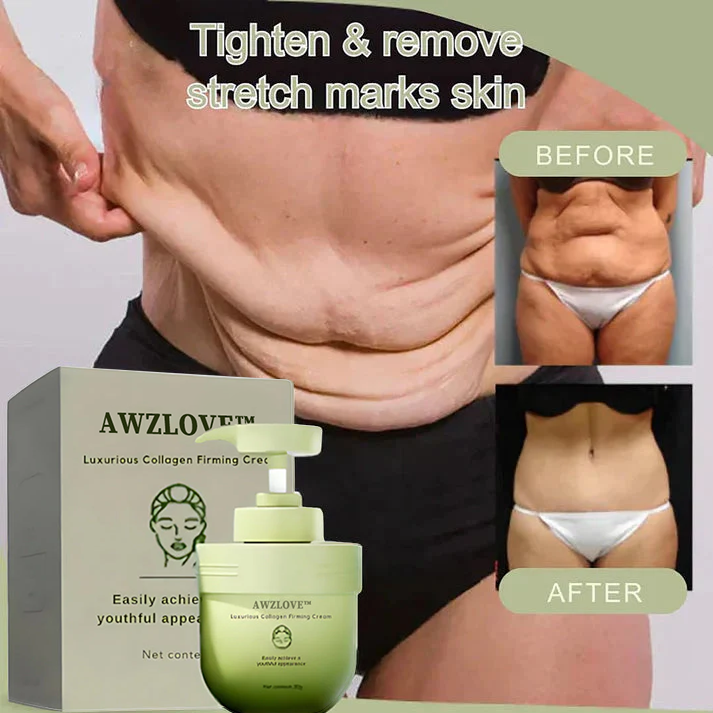 Awzlove® Luxurious Collagen Firming Cream(🔥70% Off for a Limited Time!)🐋