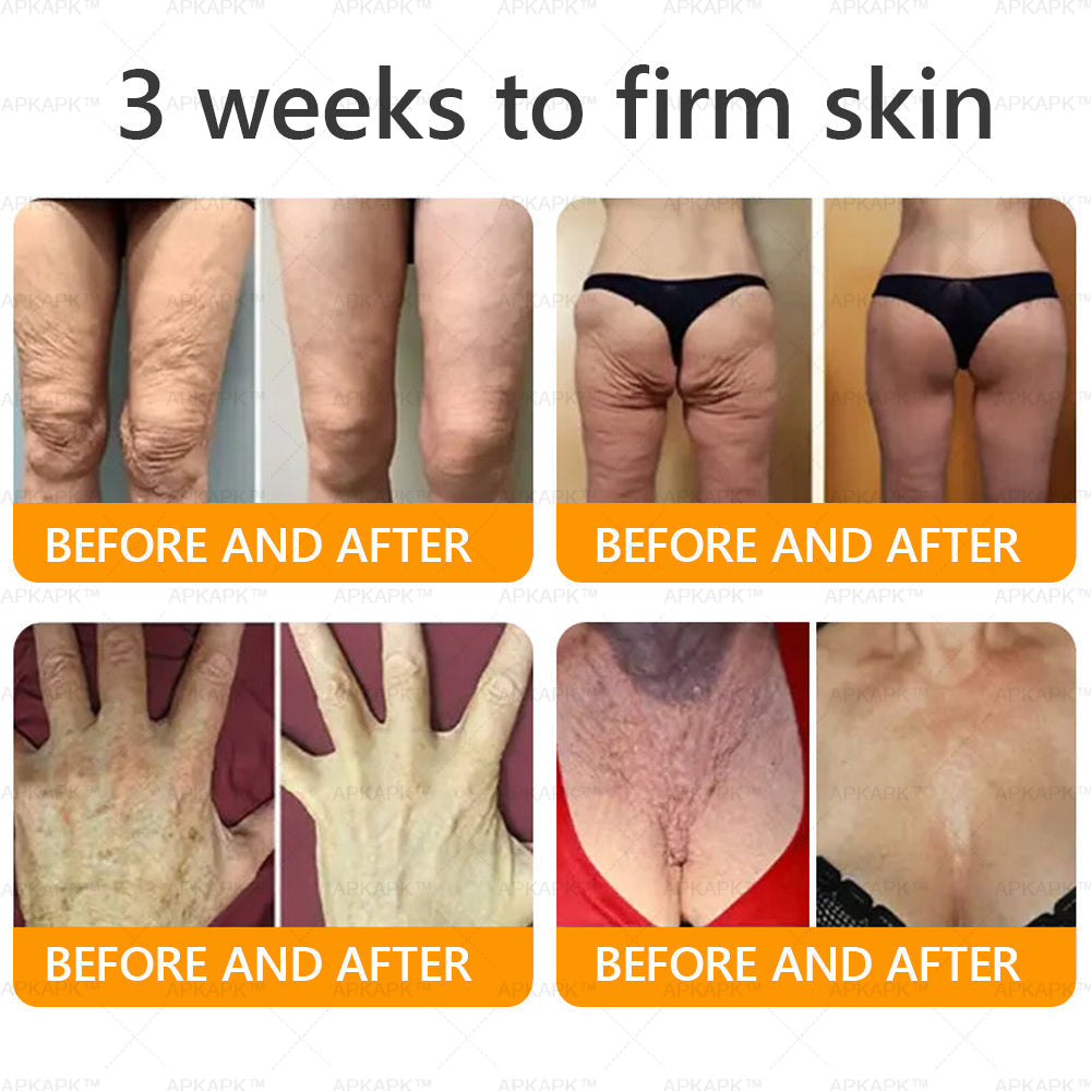 Made and Shipped from the UK ✅ 𝐀𝐖𝐙𝐋𝐎𝐕𝐄® Bee venom Comprehensive Cream 🔥 LAST DAY 80% OFF 🐝