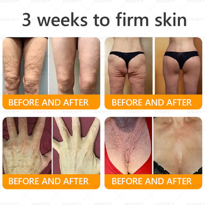 Made and Shipped from the UK ✅ 𝐀𝐖𝐙𝐋𝐎𝐕𝐄® Bee venom Comprehensive Cream 🔥 LAST DAY 80% OFF 🐝